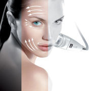 Endermolift-by-LPG-eye-lift-feature-image